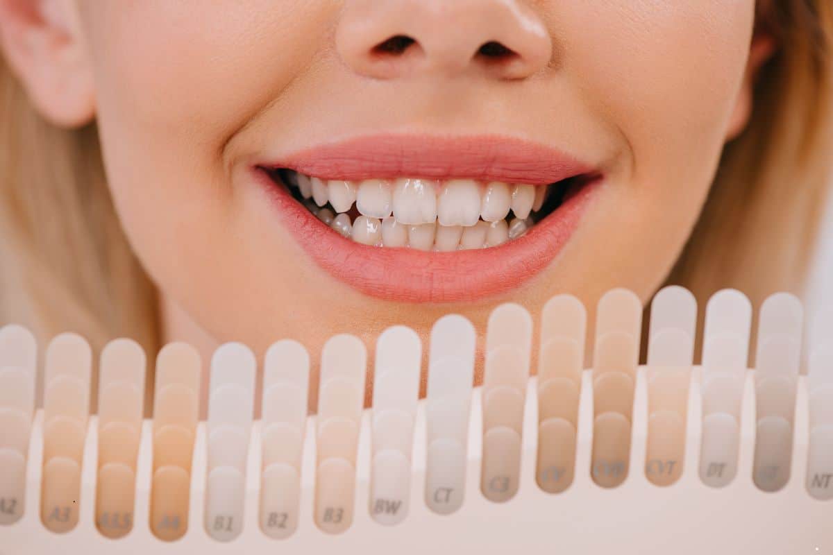 5 Signs That Your Teeth May Need Whitening