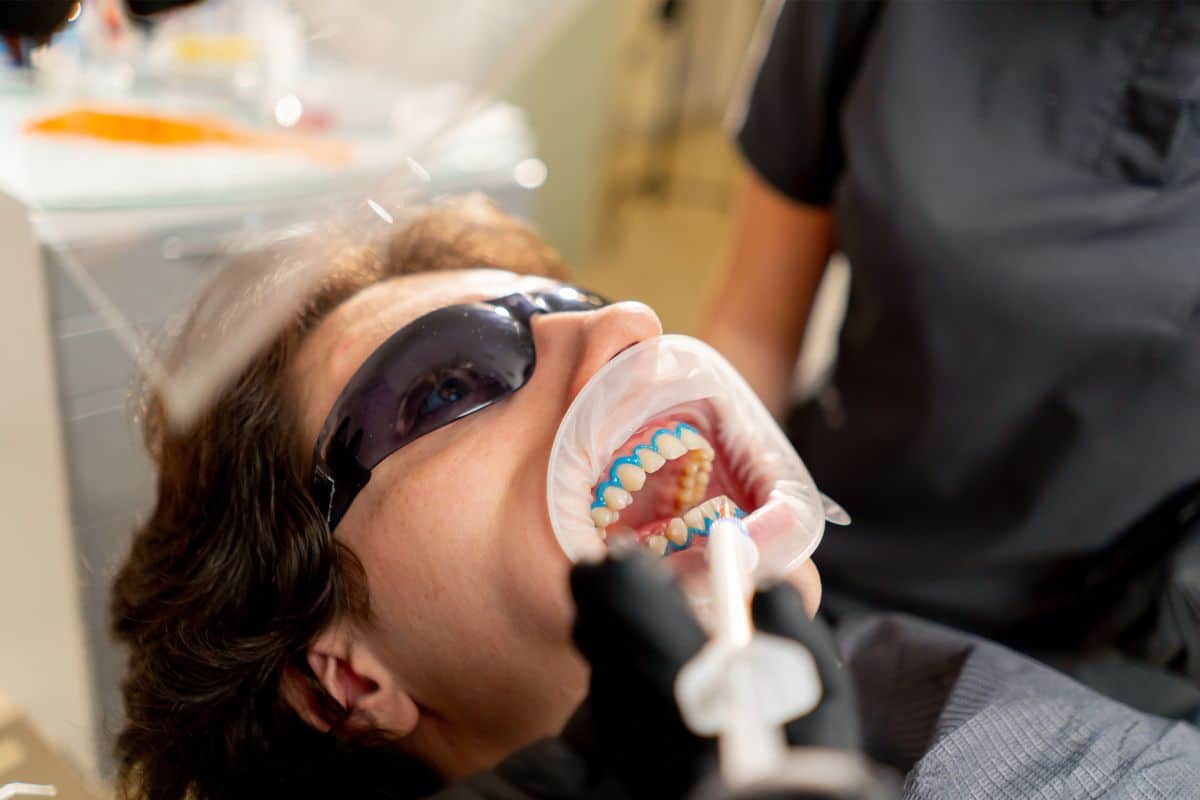Still Yellow Teeth After Teeth Whitening- Signature Orthodontics